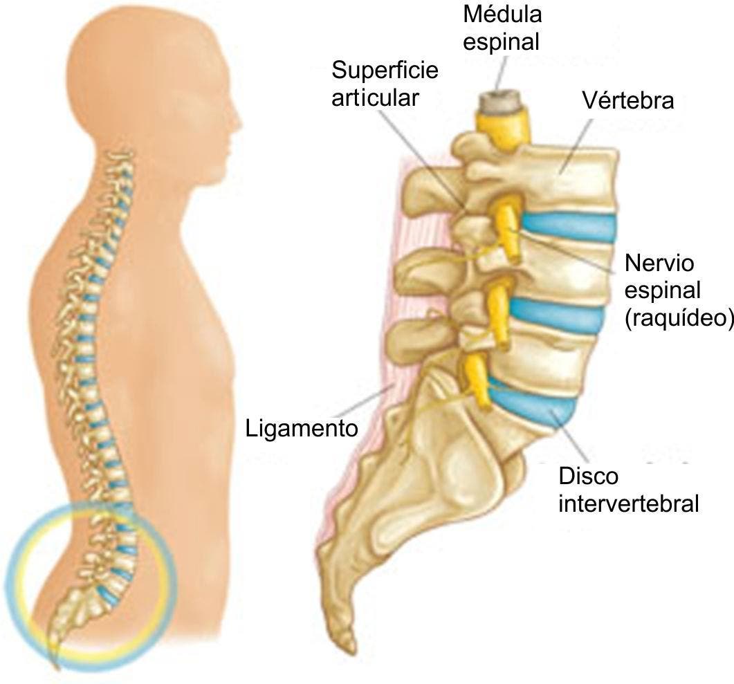 ESPONDILOSIS LUMBAR PDF