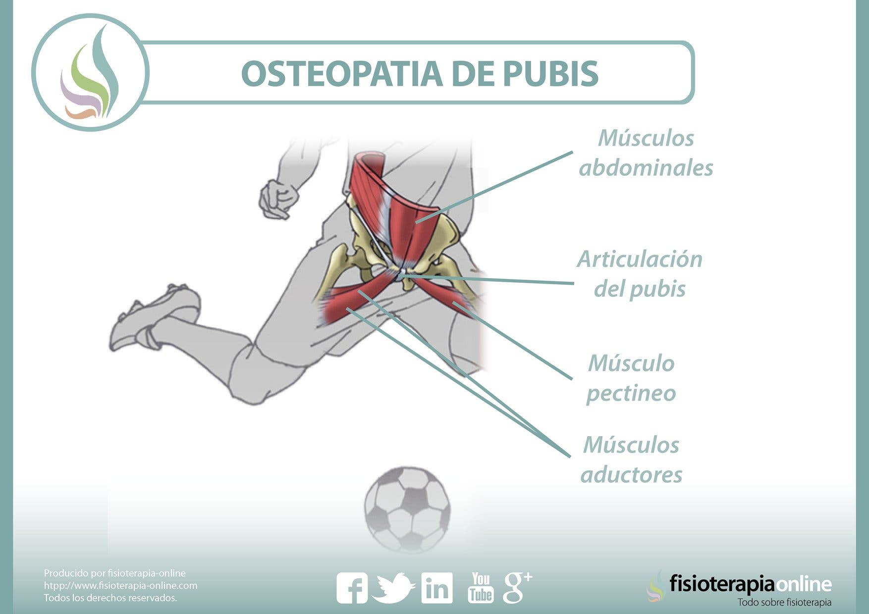 Osteopatía De Pubis Pubalgia Qué Es Causas Síntomas Tratamiento Y Consejos Fisioonline 4128