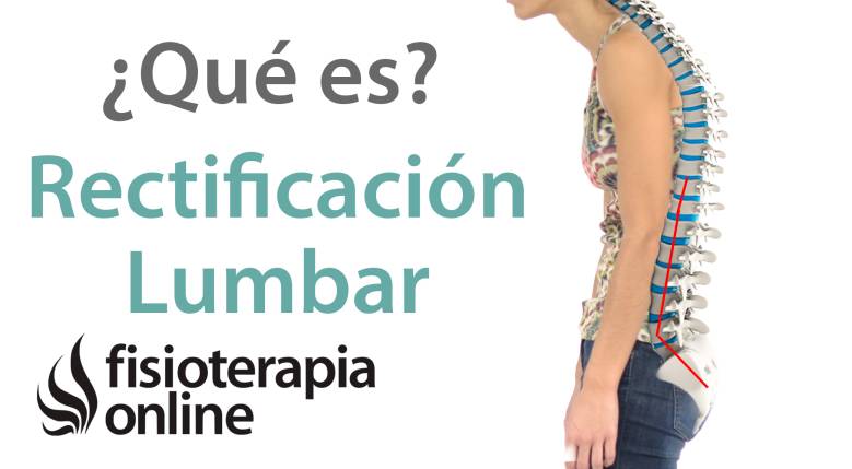 La Lordosis O Curvatura Lumbar Qu Es Consejos Y Ejercicios Para Recuperarla Fisioterapia