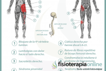 Relación del intestino delgado con el dolor de espalda