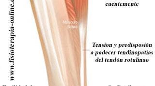 Fascitis plantar, juanetes, neuroma de Morton, conoce las consecuencias para tu salud, del uso continuado de los zapatos de tacón