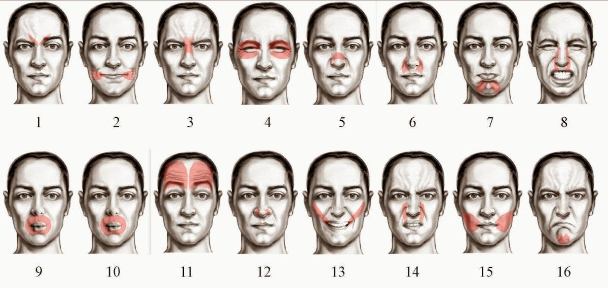 Parálisis facial. Qué es, causas, síntomas y tratamiento en fisioterapia