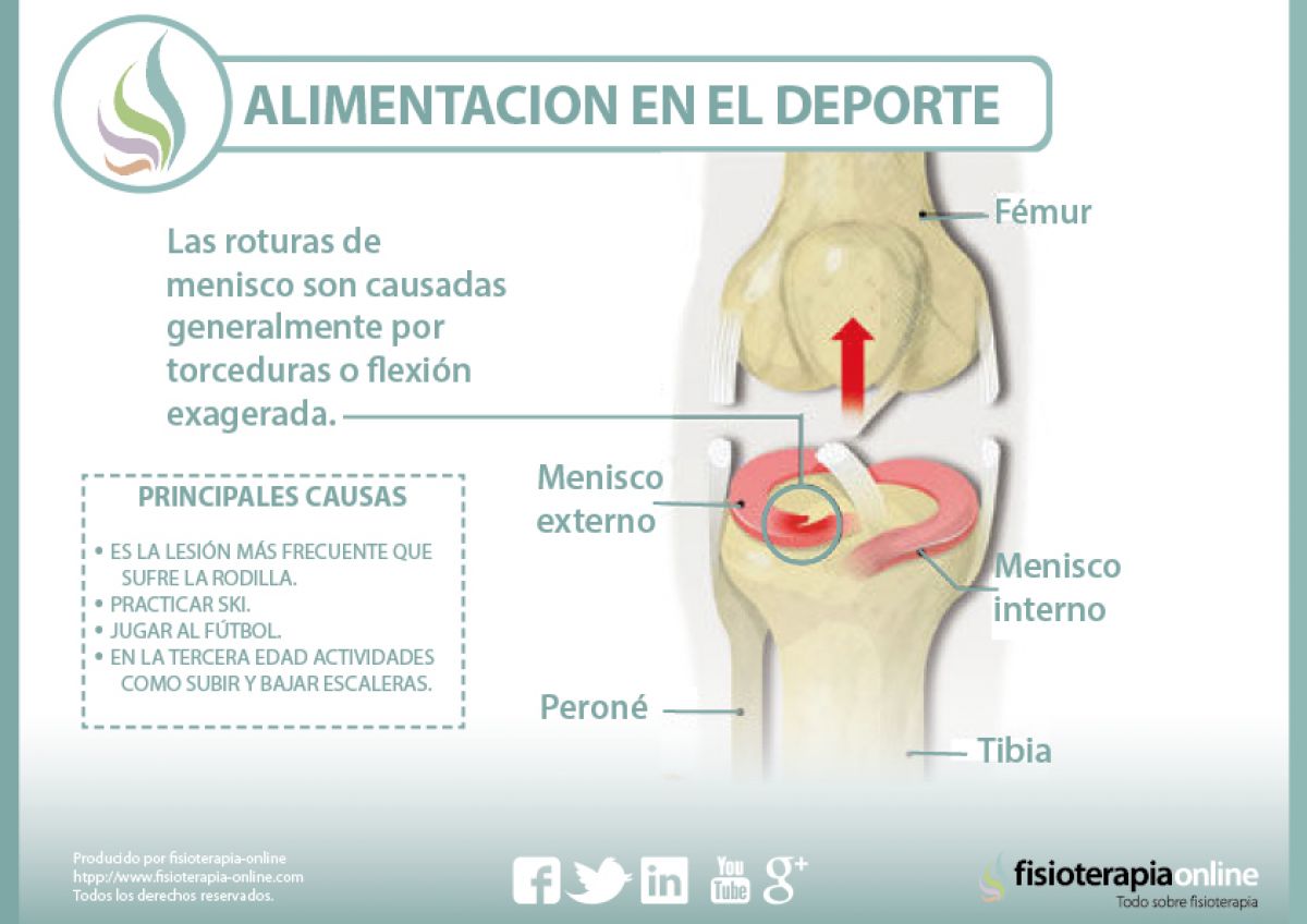 Causas Consecuencias Y Tratamiento De La Rotura De Menisco Fisioonline