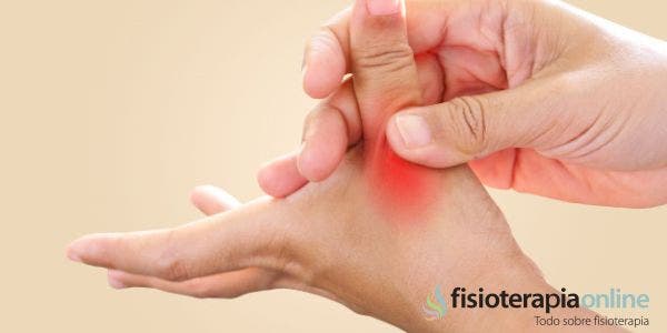 ¿Qué hacer si te diagnostican artrosis del pulgar?