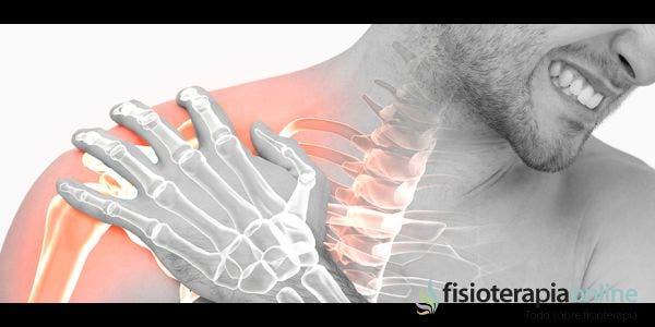 ¿Cómo recuperarse de una fractura de húmero?