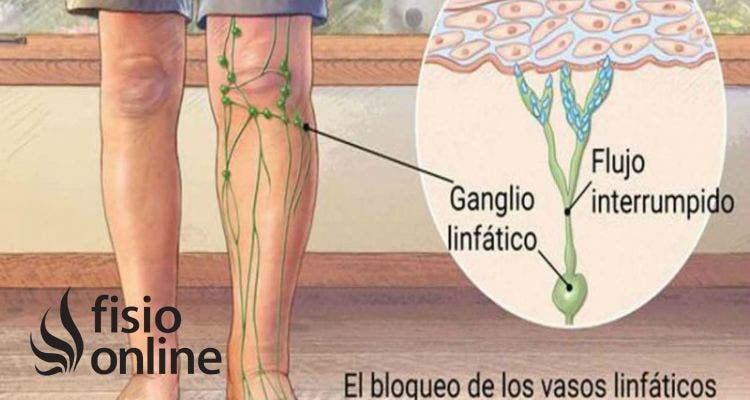 Drenaje linfatico de miembros inferiores sale