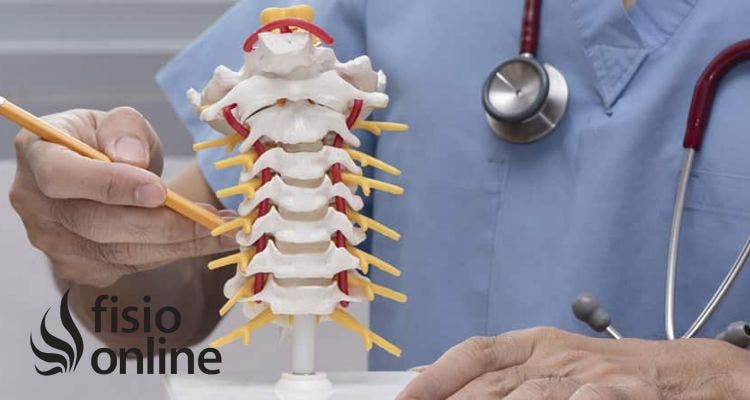 Cirugía de Hernia Discal Cervical, Cómo se realiza la operación y cómo es su rehabilitación