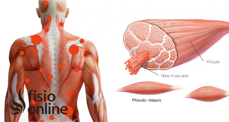 Cómo hay que cuidar los músculos de la espalda? -canalSALUD
