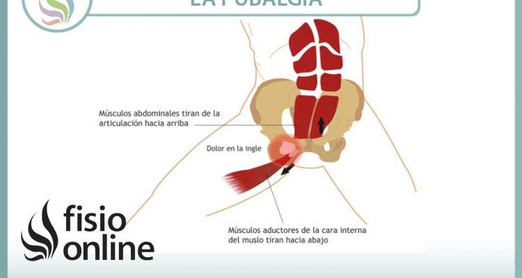 La pubalgia el castigo del futbolista