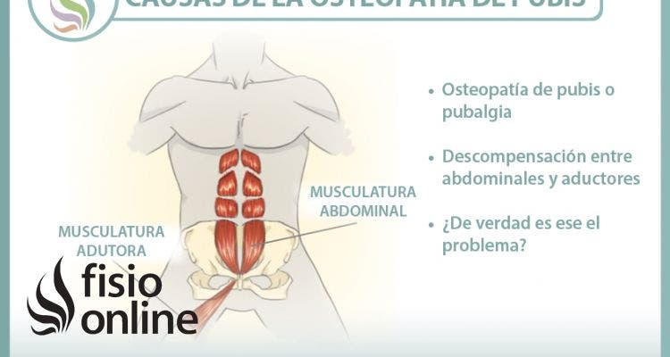 Causas de la osteopatía de pubis o pubalgia, una nueva visión