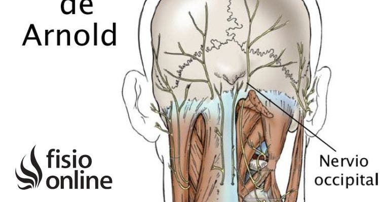 Neuralgia u occipitalgia de Arnold. Descubre sus causas, consecuencias y tratamiento