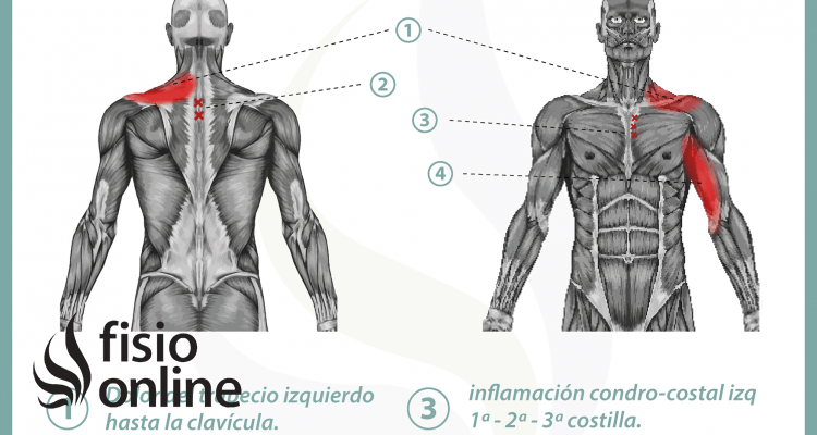 Relación entre el sistema cardio-circulatorio y el dolor de espalda