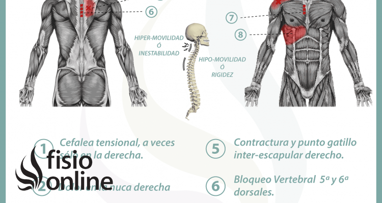 Relación entre el hígado y el dolor de espalda