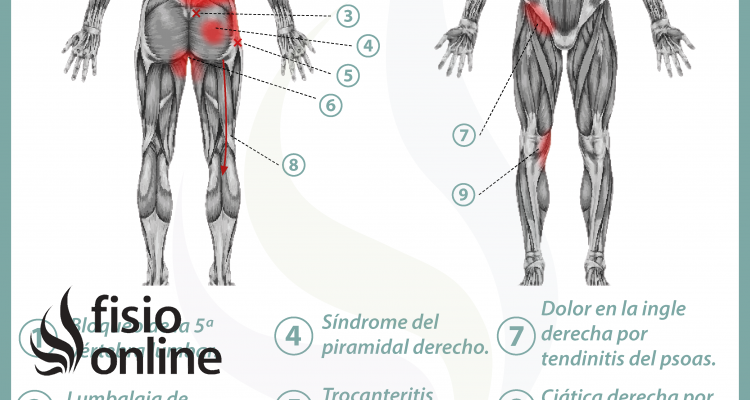 Relación entre próstata y dolor de espalda