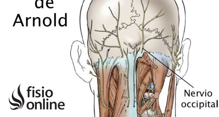 Neuralgia u occipitalgia de Arnold. Descubre sus causas, consecuencias y tratamiento