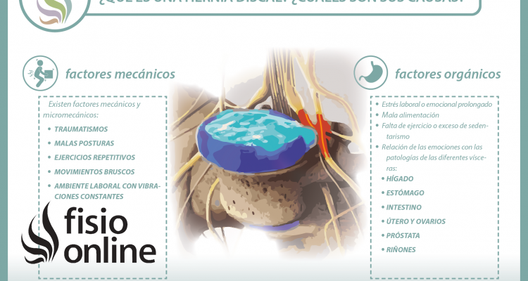 ¿Conoces todo lo necesario acerca de las hernias discales? Te ofrecemos una útil información