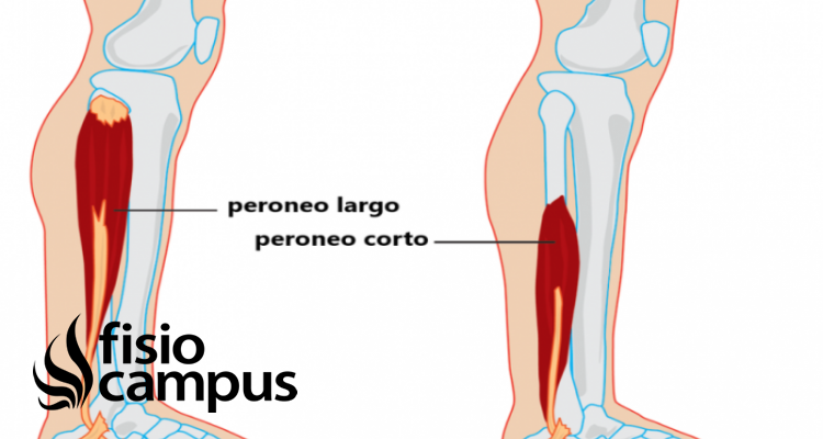 Peroneos Qué Son Ubicación Origen Inserción Función Y Lesiones 