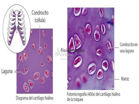 Condrocitos.