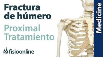 Fracturas de húmero proximal. Tratamiento quirúrgico y conservador