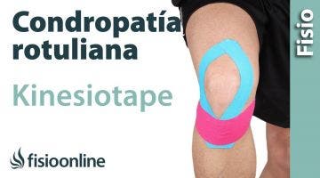 24  Kinesiotape para la condropatia rotuliana