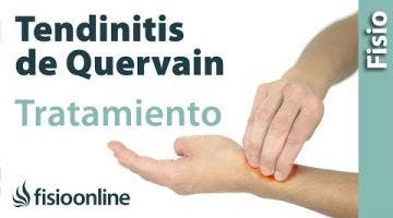 Tendinitis de Quervain. Tratamiento con ejercicios, auto-masajes y estiramientos