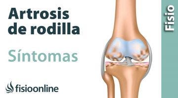 ¿Cómo entender y minimizar los síntomas de la Artrosis de rodilla?