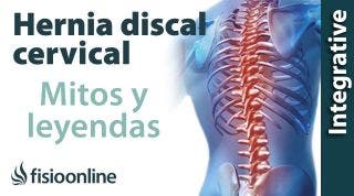 Hernia discal cervical. Desmontando mitos, leyendas y otras prohibiciones.