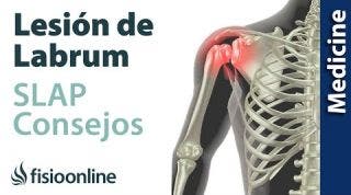 Consejos para solucionar la lesión labrum de hombro