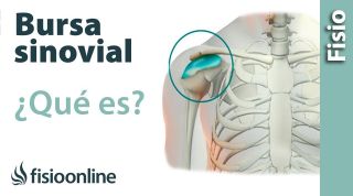 Bursitis De Hombro - Qué Es, Causas, Síntomas, Tratamiento Y Consejos ...