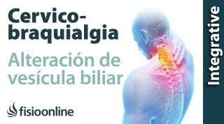 Cérvico-braquialgia Izquierda por vesícula biliar. Plantas medicinales y remedios naturales