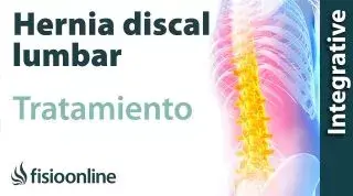 Hernia discal lumbar: Qué es, causas, síntomas, tratamiento y