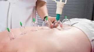 La tÃ©cnica de Cupping o Ventosas, Â¿Tiene verdaderos efectos o es un placebo?